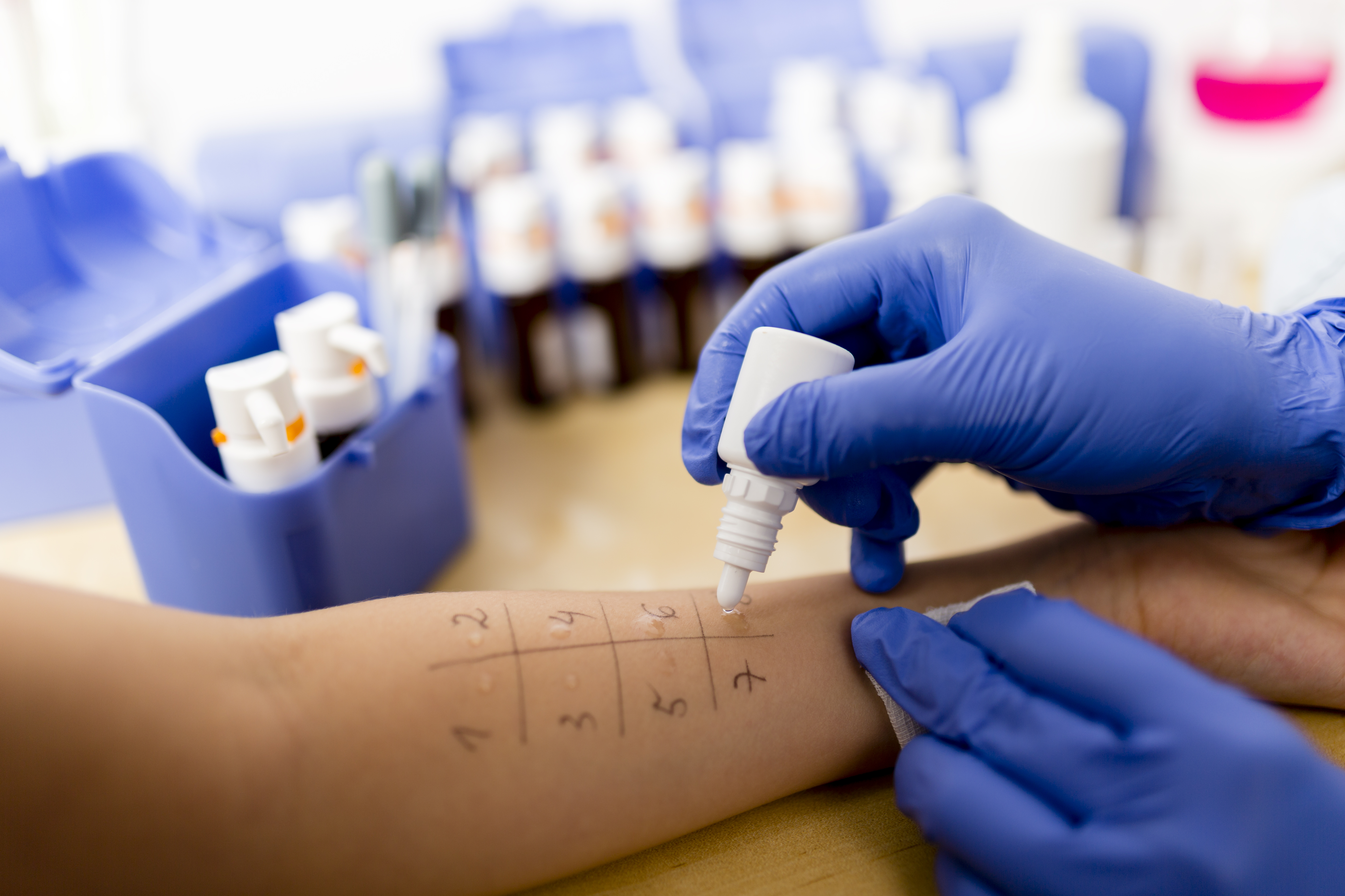 Nejnovější metoda v diagnostice alergií v podání EUC Laboratoří